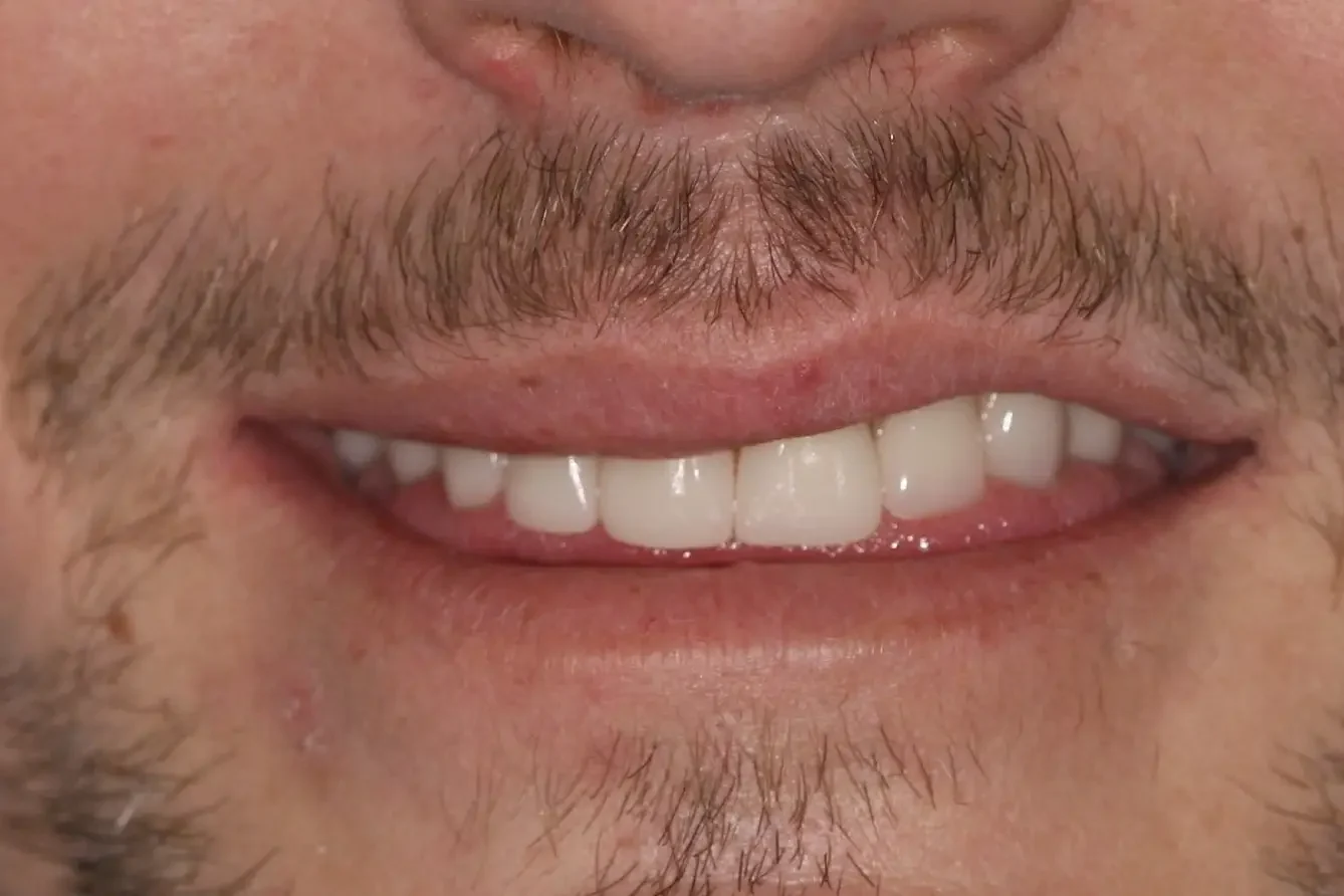 BP After e1755286852457 - Naylor Family Dental