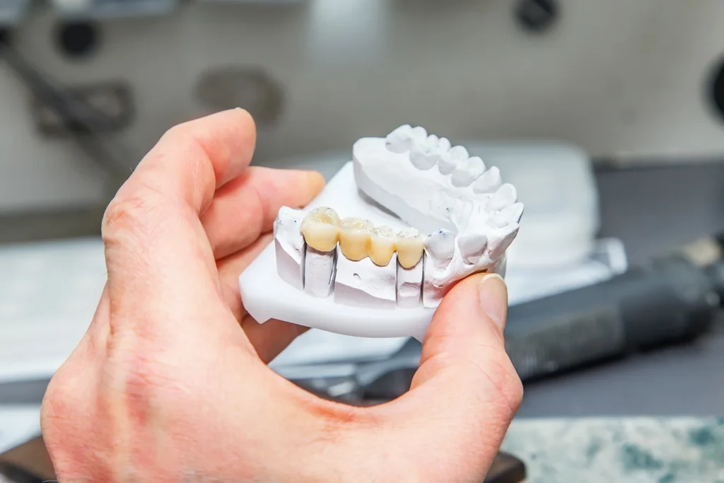 hero-image-dental-bridges