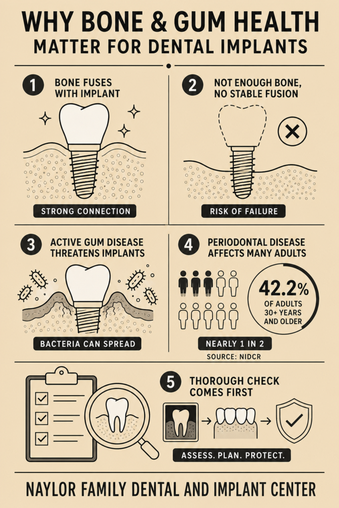 implant - Naylor Family Dental